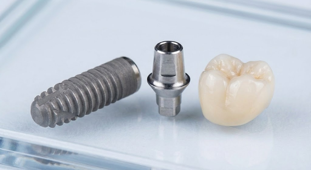 Dental Implants