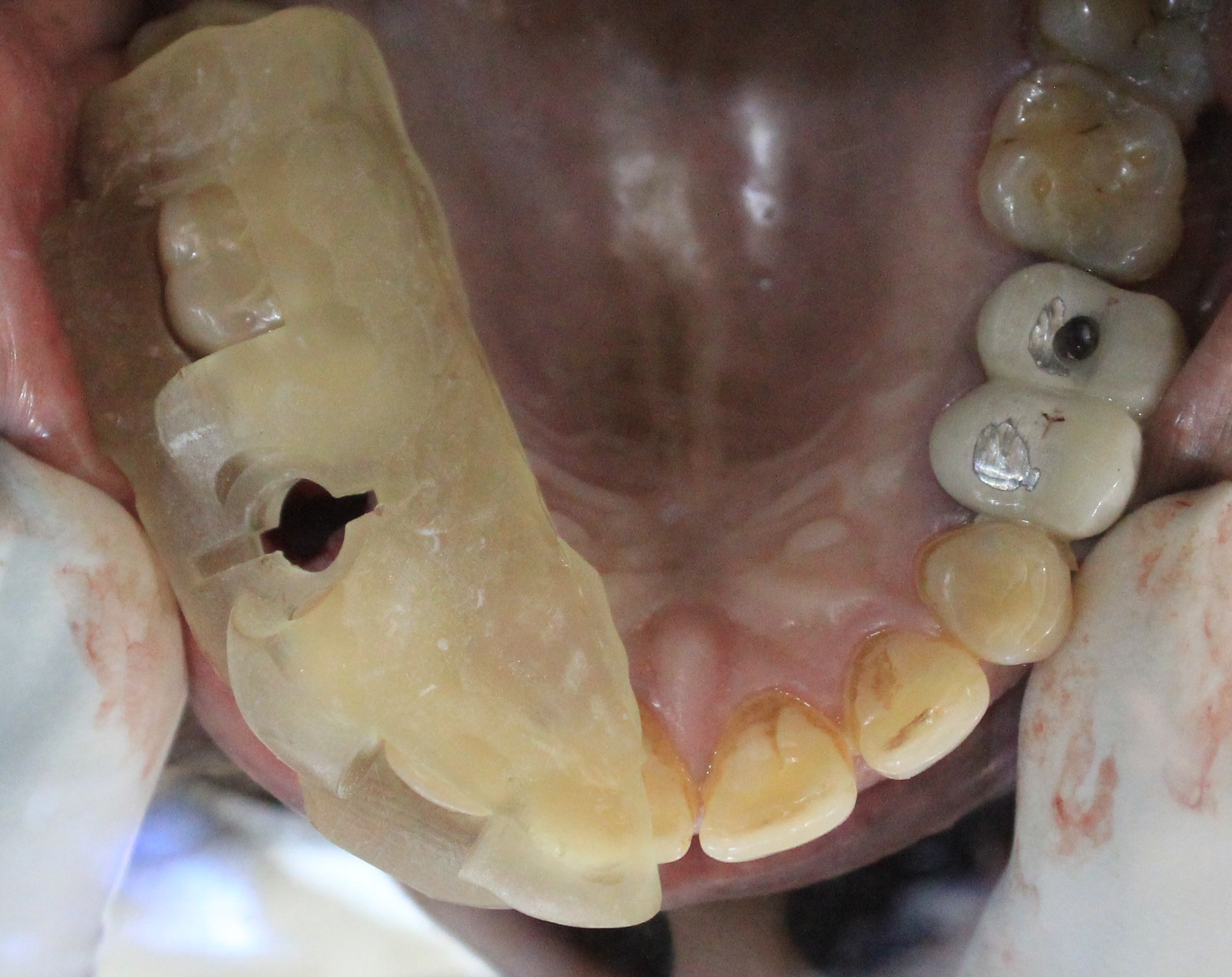 Kaushal Goyal surgical guide