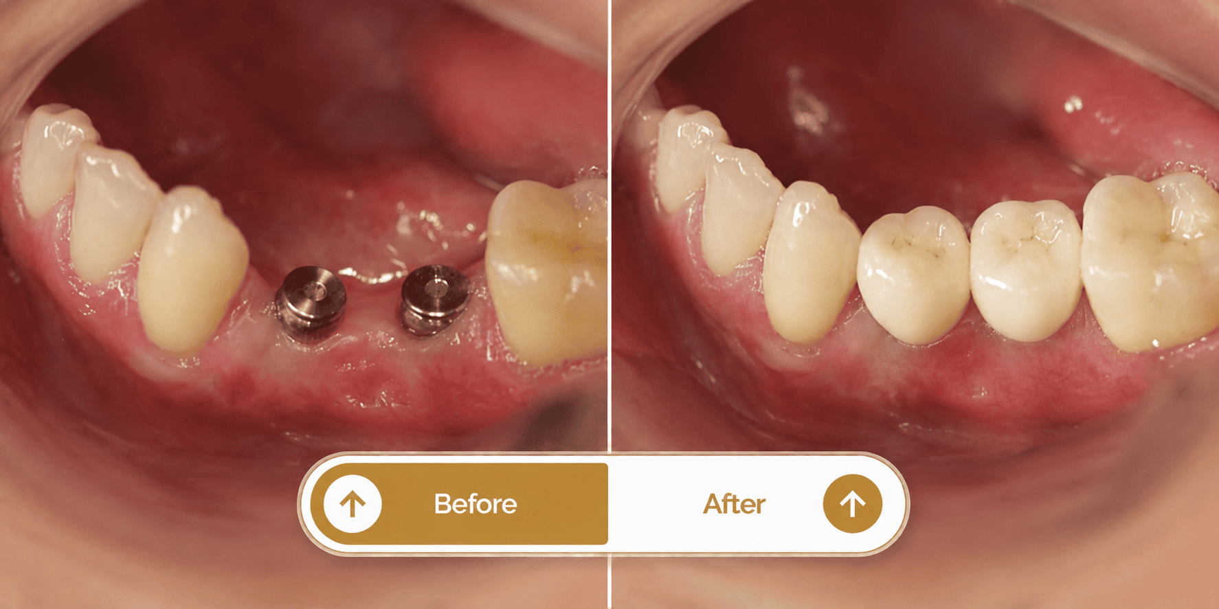 Smile transformation 2