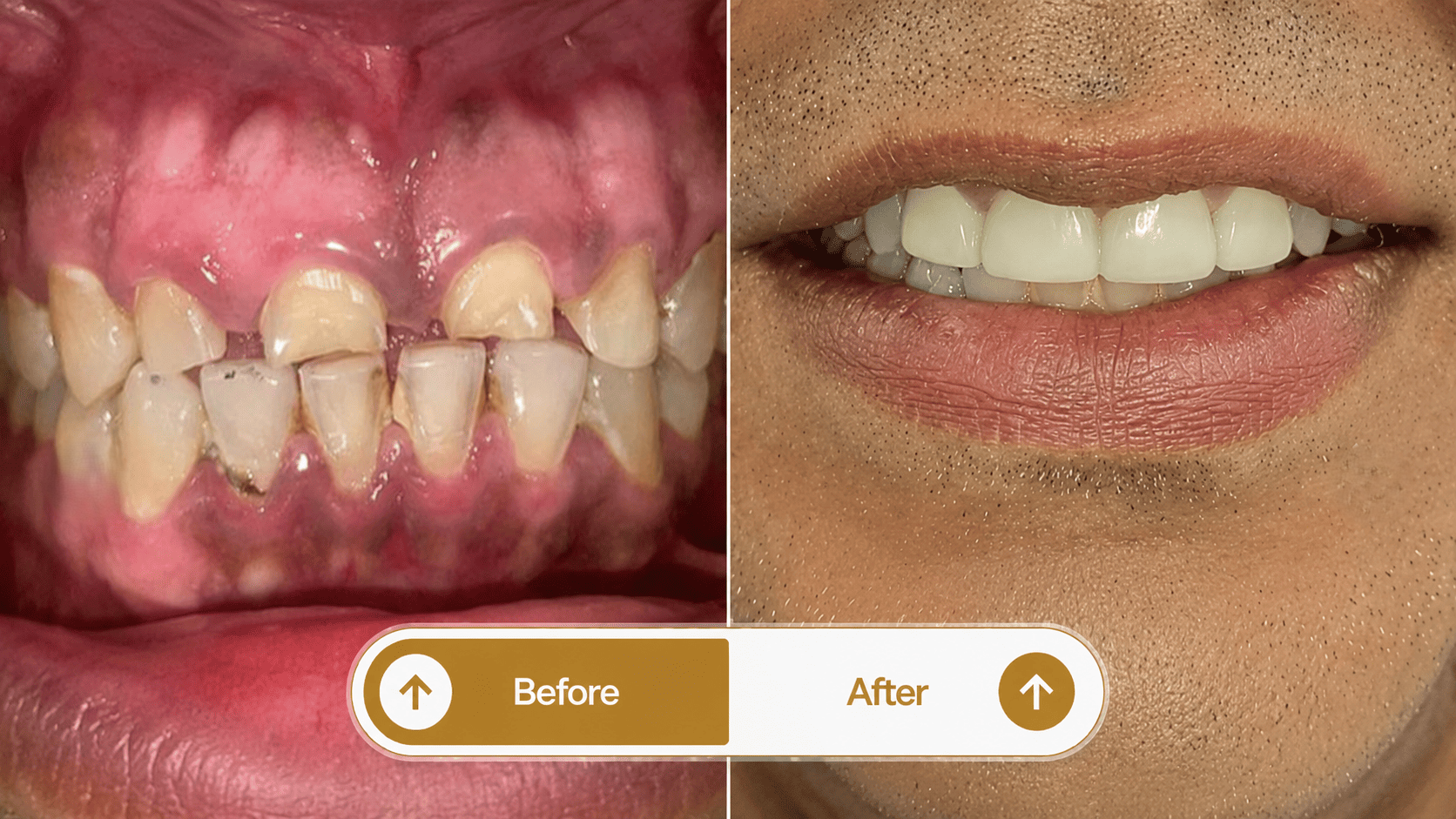 Smile transformation 2