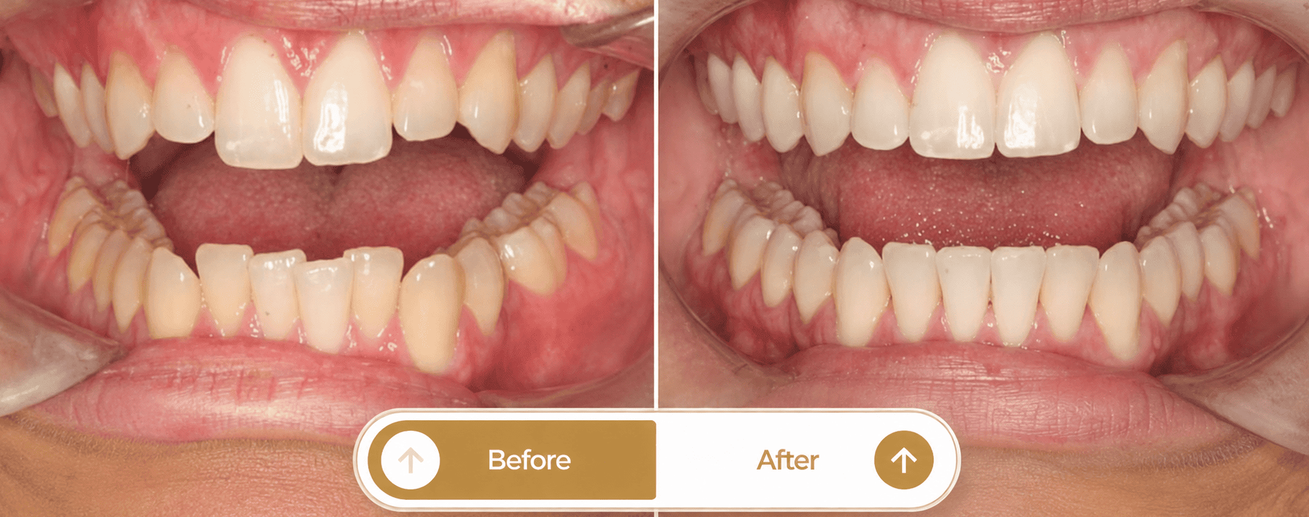 Smile transformation 1
