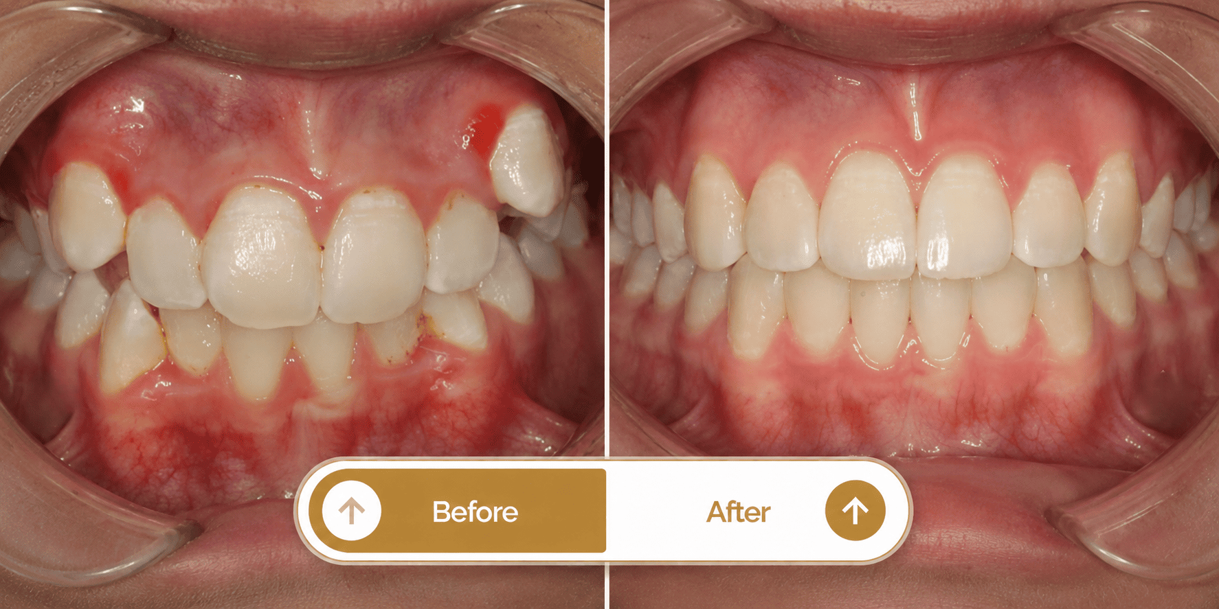 Smile transformation 2