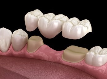 Feature image 1