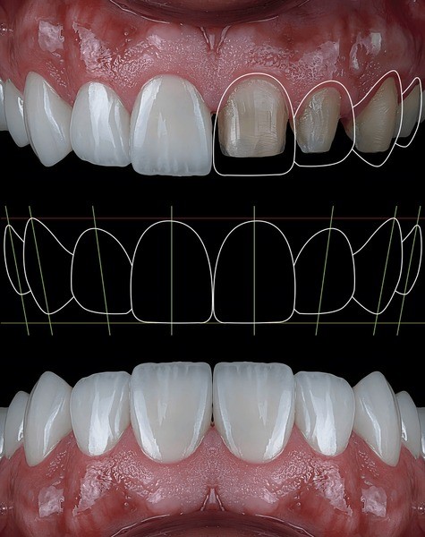 Feature image 23