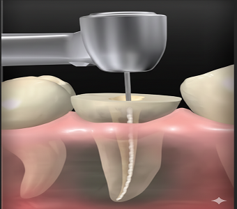 Feature image 5